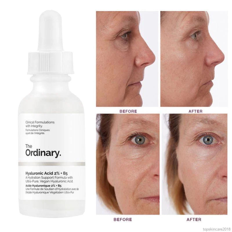 THE ORDINARY - ACIDO HIALURÓNICO+B5 30 ML