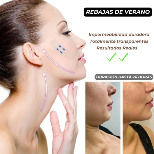 Hilos tensores para Lifting Facial X 80 Unidades Transparentes