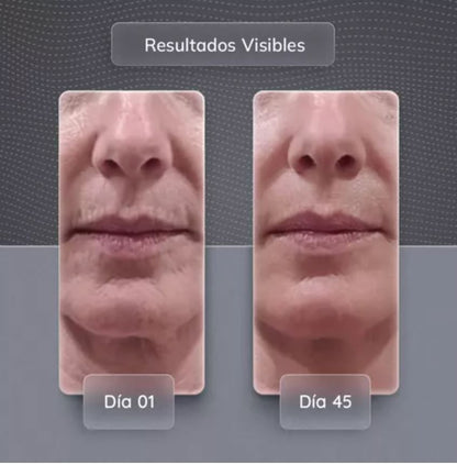 Skindion DUPE - Rodillo facial de microcorriente quita arrugas