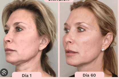 Skindion DUPE - Rodillo facial de microcorriente quita arrugas